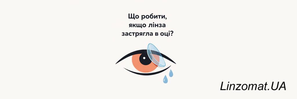 Что делать если линза застряла в глазу?