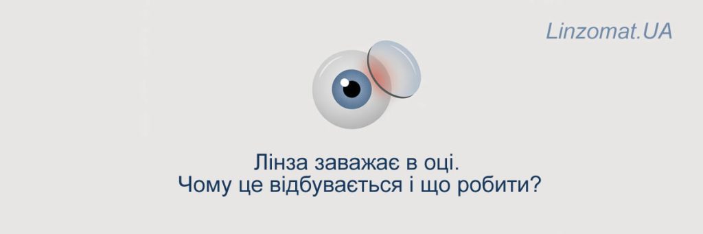 Линза мешает в глазу — почему это происходит и что делать?